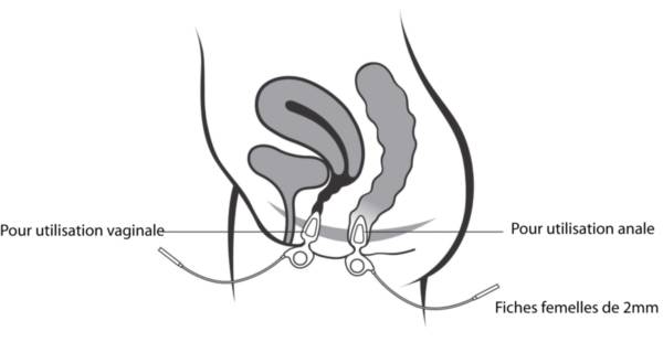 SONDE ANALE/VAGINALE ANUFORM