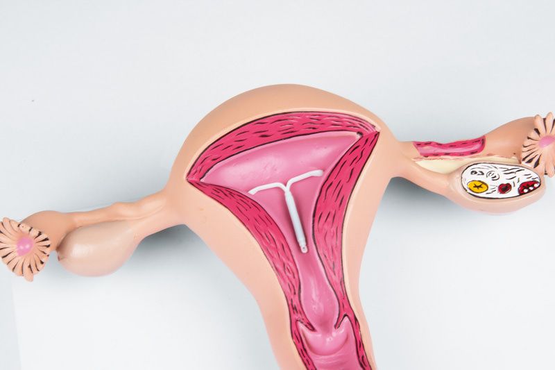 UTERUS GRANDEUR NATURE ERLER Z